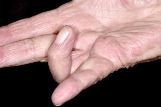 Biała prawa ręka wyciągnięta płasko z palcem serdecznym zgiętym w kierunku dłoni