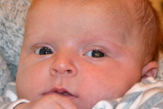 Zbliżenie twarzy dziecka z charakterystycznym białym odbiciem w źrenicy oka