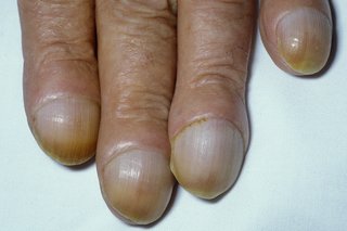 Paznokcie z pałeczkami, które wyginają się na zaokrąglonych końcach palców