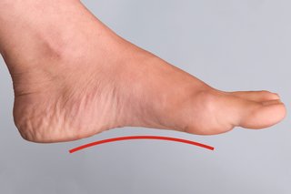 Lewa stopa kobiety z uniesionym obszarem (łukiem) widocznym wzdłuż dolnej części stopy