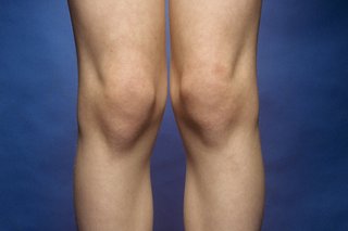 Zdjęcie uderzeń kolan